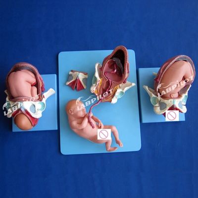 Медицинская анатомическая демонстрационная модель родов Таз и плод на полный срок